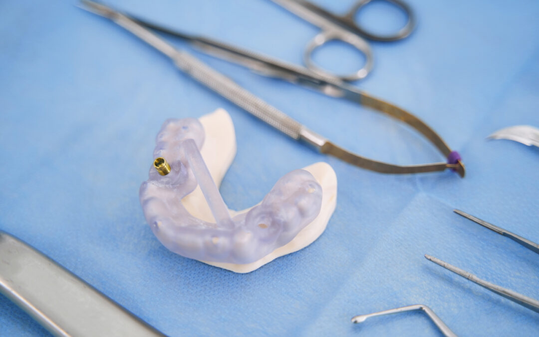 Zdrowy uśmiech a pewność siebie – jak implanty pomagają odzyskać komfort w kontaktach społecznych?